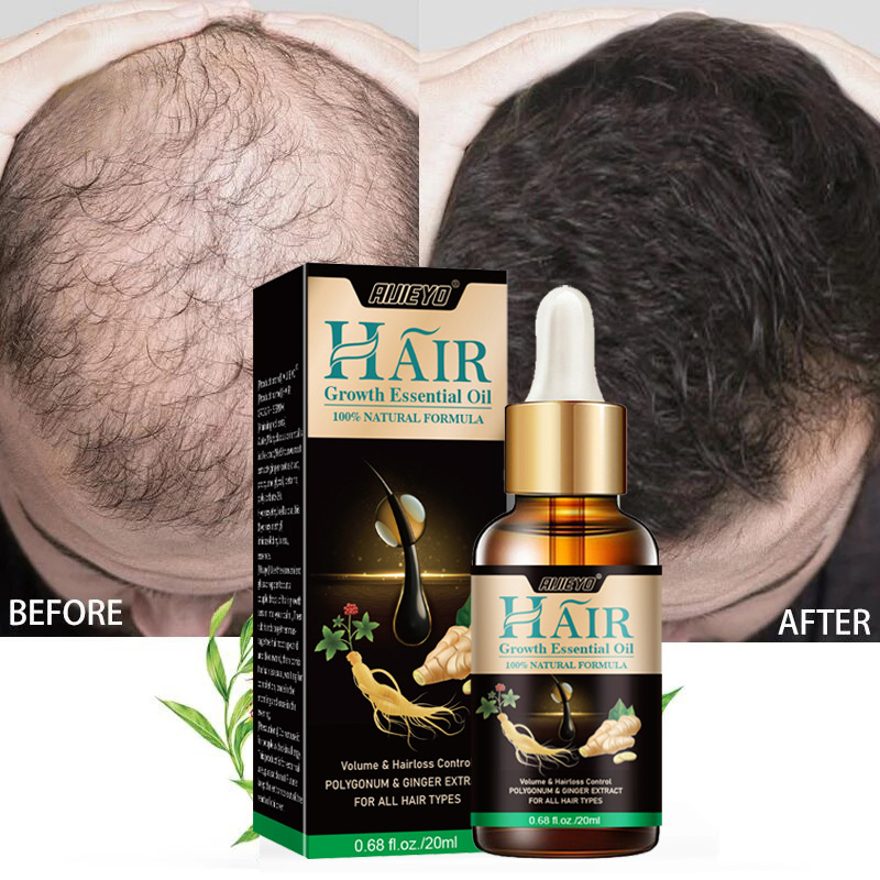 2023 Biotin minyak penumbuh ra - Licorice Root Sticks ulasan dan harga